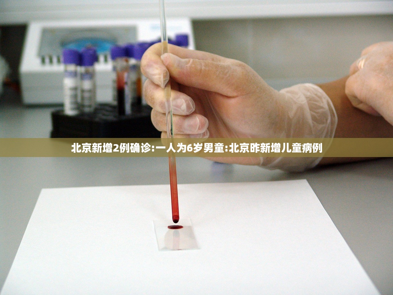 北京新增2例确诊:一人为6岁男童:北京昨新增儿童病例